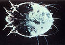 Demodex Mite Soolanta attacks the Demodex mite associated with inflammatory Rosacea