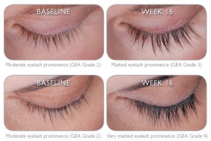Latiise Eye Lash Prescription Virtual Baseline 16 Week Growth
