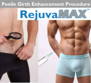 Non-Surgical Penile Girth Enhancement Dermal Filler RejuvaMAX Procedure