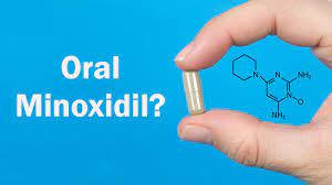 Oral Minoxidil more effective, more convenient and cheaper for hair loss online consult