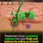 New 1st of it's kind Hair Loss Drug for Male Pattern Hair loss works by waking up dormant stem cells and reawakening hair follicle CURE for Male Pattern Baldness